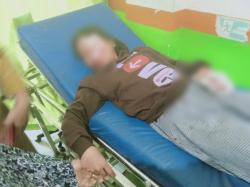 Hindari Lubang Jalan di Mamasa, Pengendara Motor Jatuh hingga Tangan Korban Kelihatan Tulang