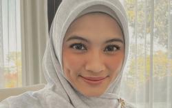 Alyssa Soebandono Diam-diam Berjuang Melawan Penyakit Skoliosis, 20 Tahun Hindari Operasi