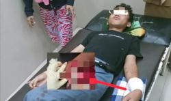 Siswa SMKN 5 Takalar Diduga Dianiaya Pakai Parang, Polisi Masih Selidiki