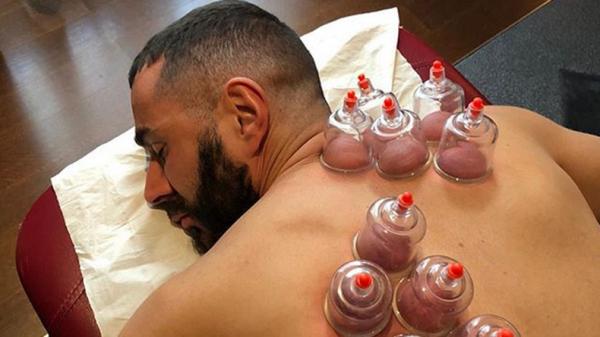 Benzema Bekam Karim Benzema mengunggah foto dirinya sedang melakukan metode bekam di akun Instagram miliknya, Rabu (13/11/2019). (Foto: Instagram @karimbenzema)