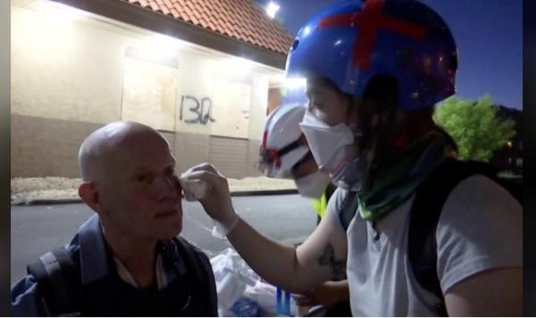 Reuters Journalits Seorang jurnalis mendapat perawatan usai jadi sasaran tindakan represif aparat saat meliput demonstrasi antirasial di Minneapolis, Ameria Serikat