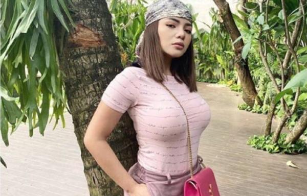 Dinar Candy Implan Payudara Dinar Candy. (Foto: Istimewa)