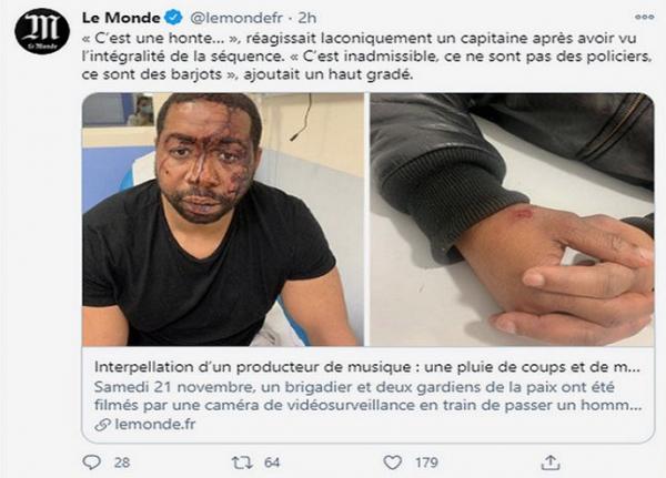 Foto penganiayaan Tangkapan layar foto pria berkulit hitam dalam kondisi wajah bonyok dan berdarah diduga usai mengalami kekerasan oleh polisi. (foto: Twitter)