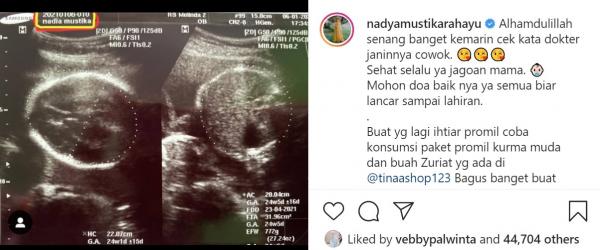 Nadya Mustika USG