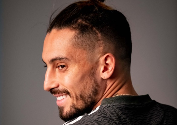 Bek Manchester United (MU) Alex Telles punya codet di kepala. Namun dia justru bangga dengan bekas luka tersebut. (Foto: Manchester United)