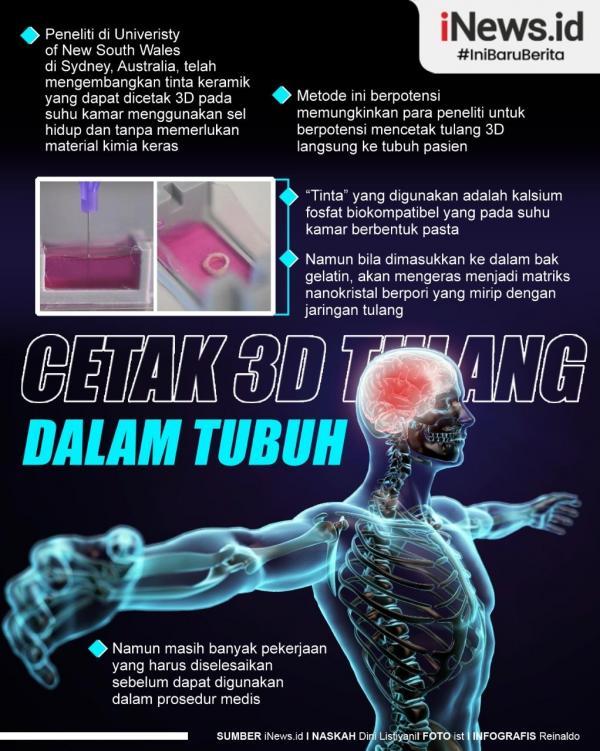 Grafis Foto Tulang 3D 1 Gubernur Kalimantan Tengah Sugianto Sabran. (Foto: Dok Pemprov Kalteng)