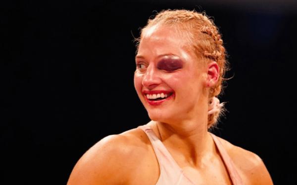 Wajah petinju cantik Ebanie Bridges bonyok dihajar lawannya Shannon Courtenay, Minggu (11/4/2021). Matanya memar sangat besar. (Foto: New York Fights)