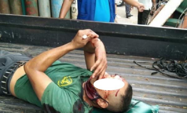 Korban ledakan tabung oksigen di Pontianak, Kamis (12/8/2021). (Foto: Antara)