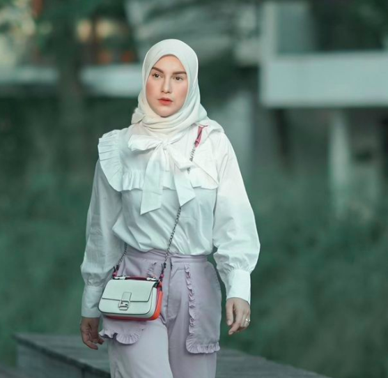 Irish Bella Artis cantik bergigi gingsul dengan senyum manis. (foto: Instagram)