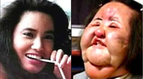 10 Deretan Artis Operasi Plastik Deretan artis gagal operasi plastik. (Foto: Instagram)
