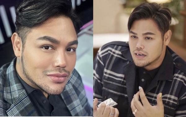 Ivan Gunawan turun 40kg Artis Punya Julukan Aneh dan Unik. (Foto: Instagram)