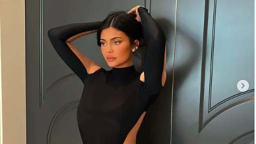 Artis Pakai Gigi Emas. (Foto: Instagram)