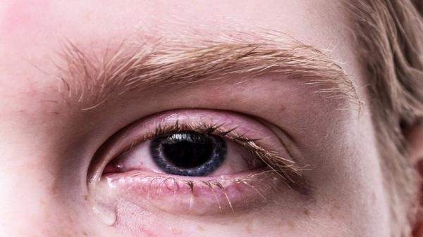 Ilustrasi Bahaya Menggunakan Softlens Setiap Hari (Foto: Pixabay) Ilustrasi Bahaya Menggunakan Softlens Setiap Hari (Foto: Pixabay)