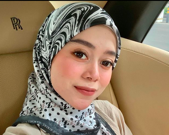 Artis yang pernah mengalami abusive relationship. (foto: Instagram)