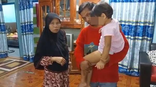 Bocah empat tahun di Bukittinggi, Sumbar, digigit anjing (Wahyu Sikumbanmg/MNC Portal)