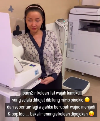Lucinta Luna mau operasi wajah di Thailand. (Foto: instagram)