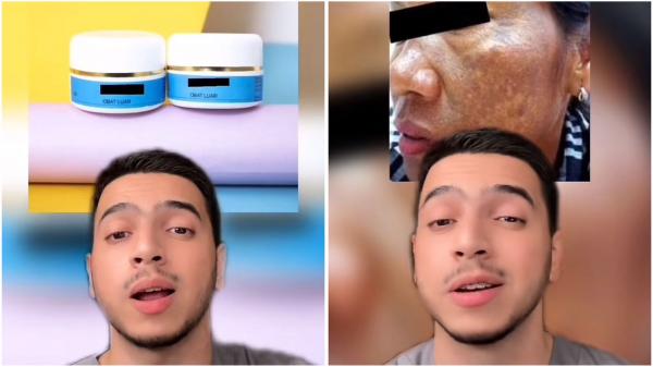 dr Farhan bicara soal etiket biru dr Farhan bicara soal dampak buruk krim etiket biru. (Foto: TikTok)