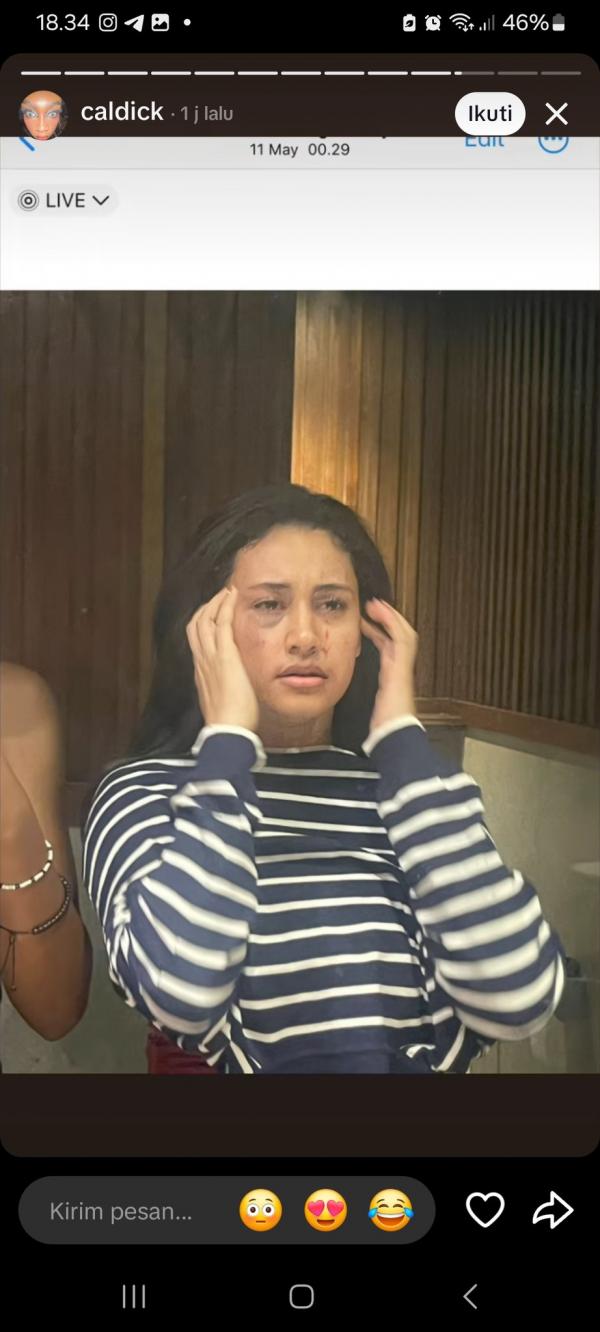 Afifah Riyad kdrt Afifah Riyad pamer foto wajah penuh luka. (Foto: Instagram)