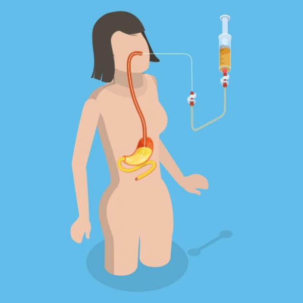 ilustrasi cuci lambung ilustrasi cuci lambung. (Foto: iStock)