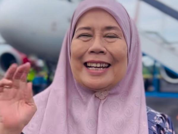 Dewi Yull Dewi Yull mengalami kebutaan pada mata kanan. (Foto: Instagram)