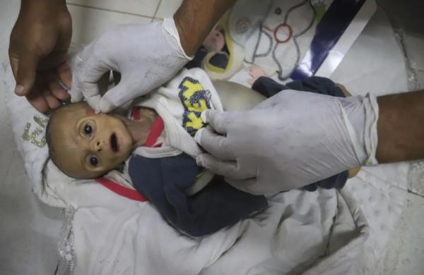 PBB: Israel Hancurkan RS Anak di Gaza, Bikin Bayi Cacat Seumur Hidup