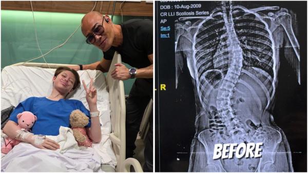Nada anak Deddy Corbuzier Nada anak Deddy Corbuzier jalani operasi skoliosis. (Foto: Instagram)