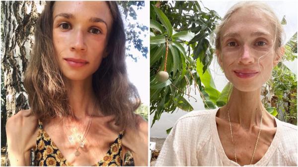 Bule tewas di Bali gegara diet ekstrem Bule Polandia tewas di Bali gegara diet ekstrem. (Foto: Instagram)
