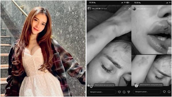 Aprillya Nabilla menjadi korban kekerasan orang misterius. (Foto: Instagram)
