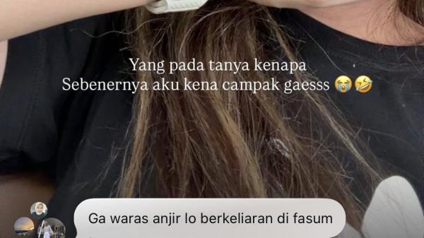 Postingan Ruce Nuenda yang bikin netizen murka. (Foto: Instagram)