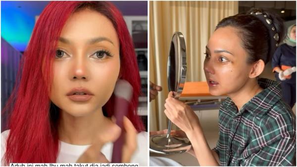 Rina Nose memamerkan wajah baru usai operasi plastik hidung. (Foto: Instagram)