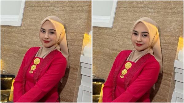Ria Ricis Ria Ricis tampil berbeba dengan hidung baru. (Foto: Instagram)