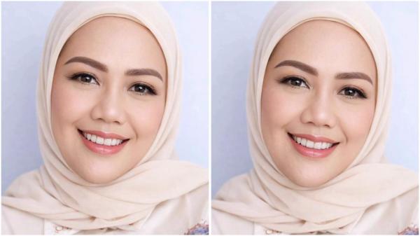 Heboh! Elly Sugigi Hanya Incar Pria Ganteng untuk Dinikahi usai Oplas Hidung