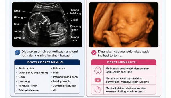 Sering Dianggap Ketinggalan, USG 2D Ternyata Lebih Akurat Deteksi Kelainan Janin