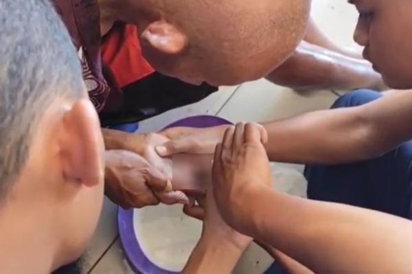 Dramatis! Petugas Damkar Bantu Lepas Cincin Kawin Terjepit di Jari Manis Lansia 93 Tahun