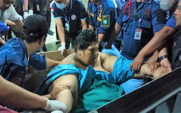 Hasil Cek Laboratorium Fajri Obesitas 300 Kilogram Semua Normal, hanya Kaki Infeksi Bekas Kecelakaan