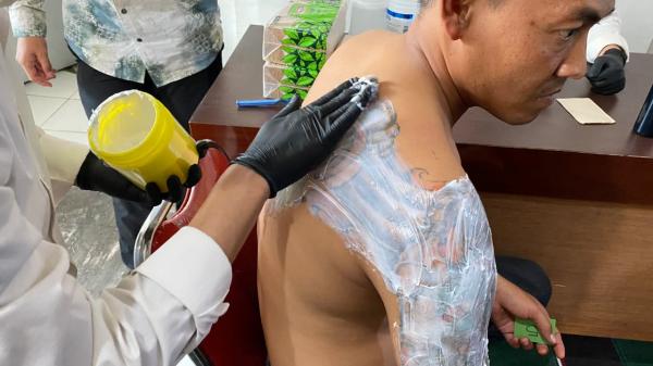 Hapus Tato Gratis di Bandung: Bantu Warga Memulai Hidup Baru Tanpa Stigma