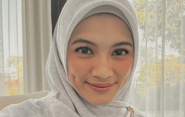 Alyssa Soebandono Diam-diam Berjuang Melawan Penyakit Skoliosis, 20 Tahun Hindari Operasi