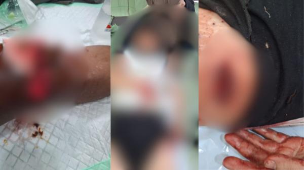 Breaking News! Tembakan Pecah di Festival Lembah Baliem Wamena, Dua Pengunjung Terluka