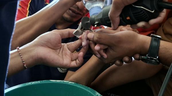 Jari Bocah 6 Tahun Terjepit Grendel Jendela, Damkar Lamongan Turun Tangan