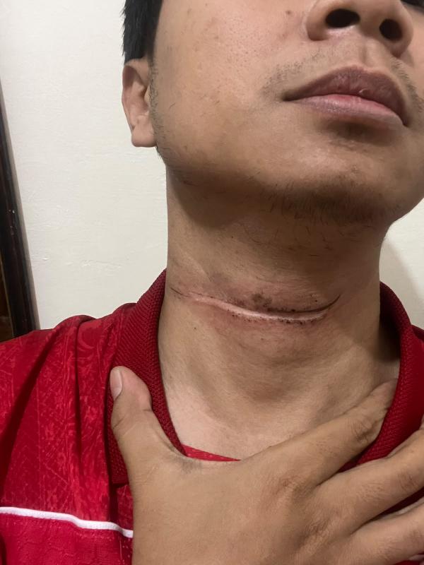 Dua Kali Warga Terjerat Kabel Internet di Sragen, Pemkab Desak ISP Tertib