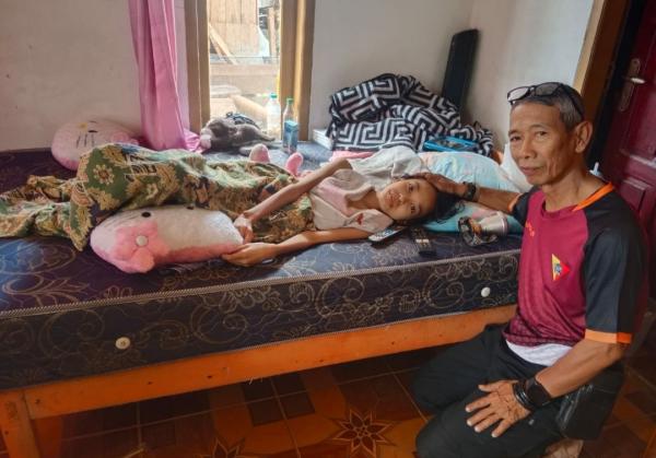 15 Tahun, Siti Lestari Berjuang Lawan TBC, Harapan Sembuh Masih Panjang