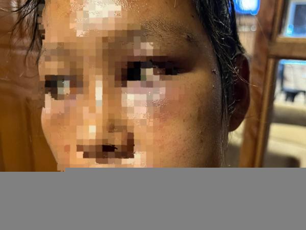 Cemburu Istri Tak Ada di Rumah, Pria di Mamuju Tengah Tega Aniaya Korban hingga Luka-Luka