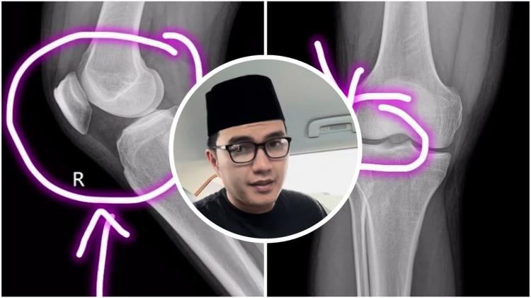 baca_juga