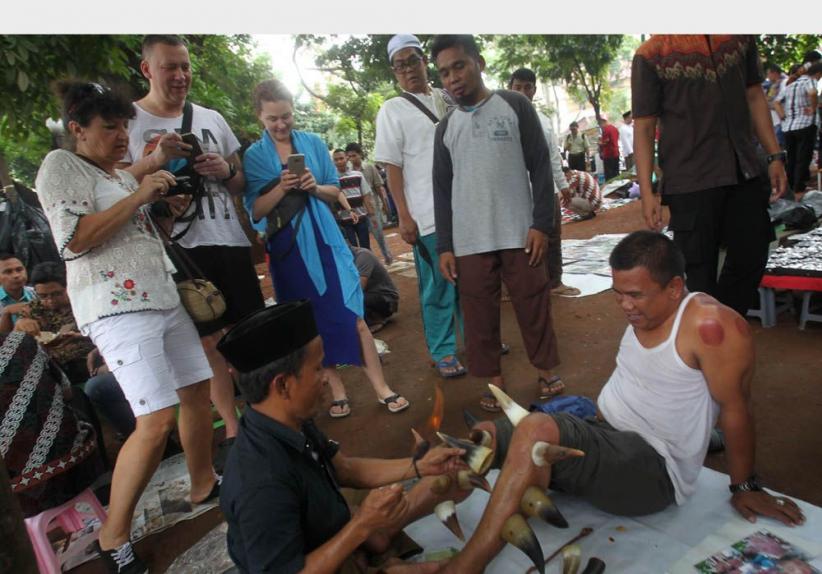 Unik, Terapi Bekam dengan Tanduk Kerbau - Bagian 3