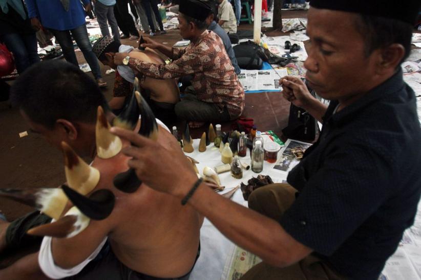 Unik, Terapi Bekam dengan Tanduk Kerbau - Bagian 6