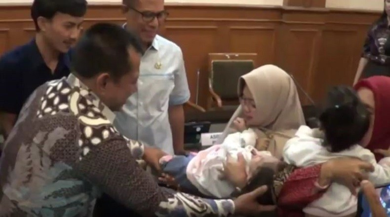 Bayi Kembar Siam Akila dan Azila Tetap Dipantau Dokter Meski Sudah Boleh Pulang
