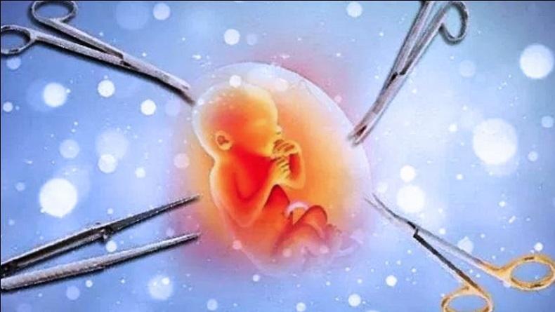 Malu Hamil Tanpa Suami, Ibu di Bantul Aborsi