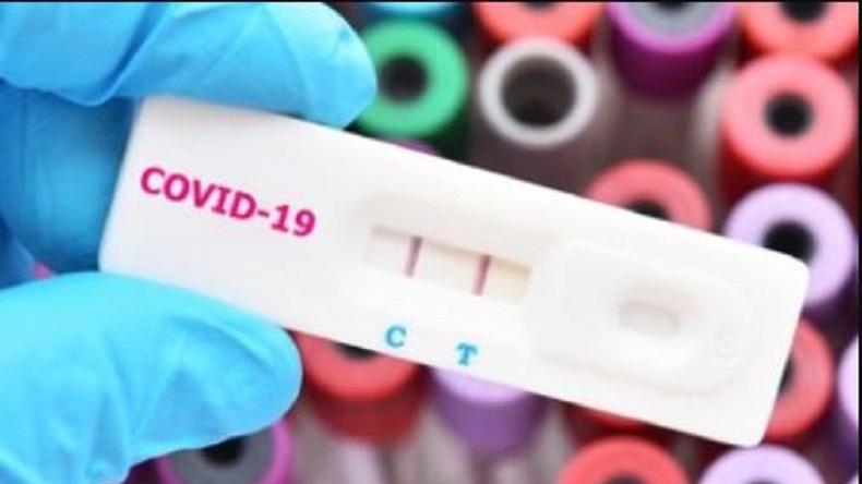 115 Orang di Maluku Utara Positif Covid-19 Hasil Rapid Test