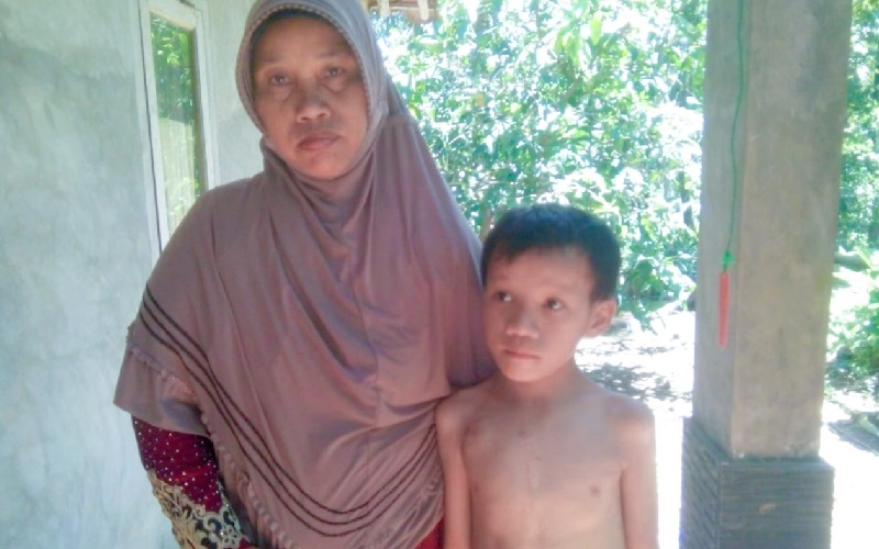 Miris, Anak Usia 11 Tahun di Pangandaran Hidup dengan Bocor Jantung