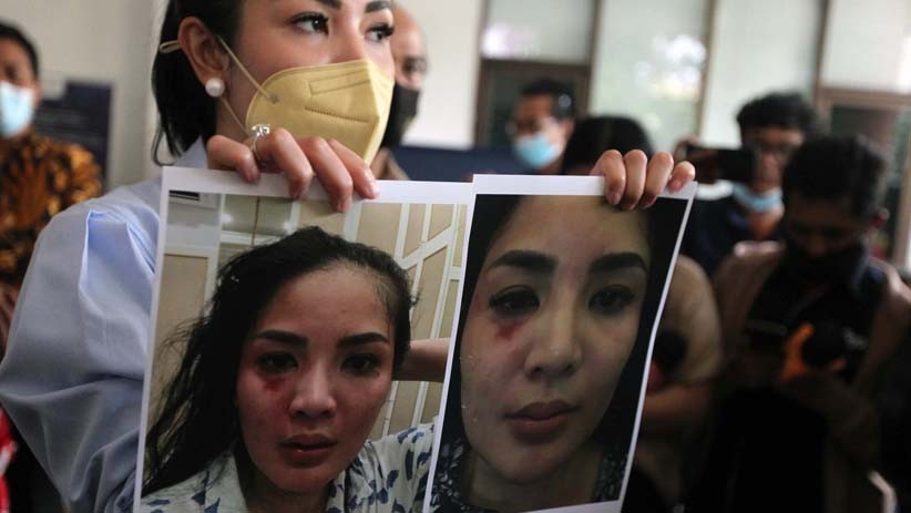 Ini Wajah Lebam Nindy Ayunda akibat KDRT, Ditunjukkan kepada Komnas Perempuan - Bagian 2